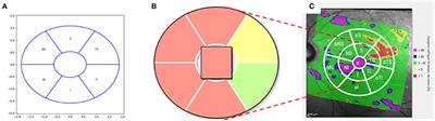 Extended Ganglion Cell Layer Thickness Deviation Maps With OCT in Glaucoma Diagnosis